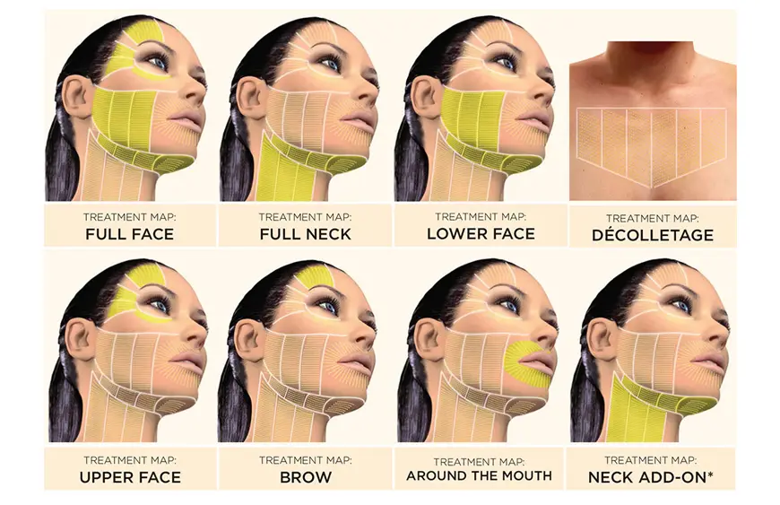 Image showing face, neck, and chest areas being treated with HIFU